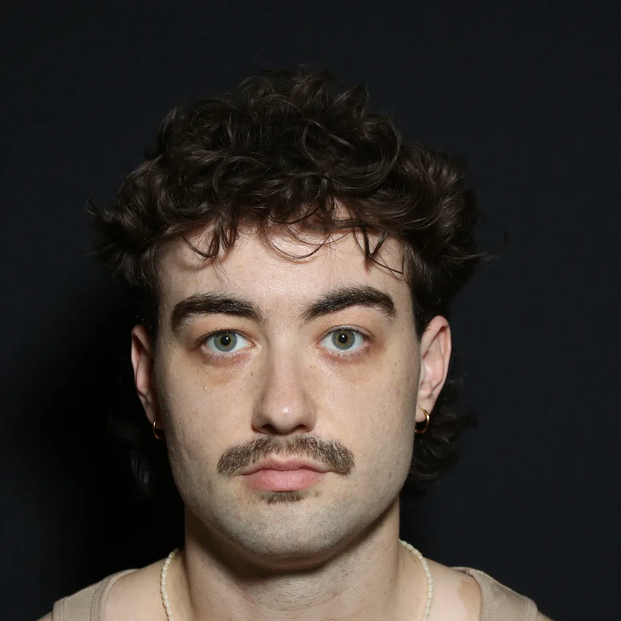 Ata, before jawline filler