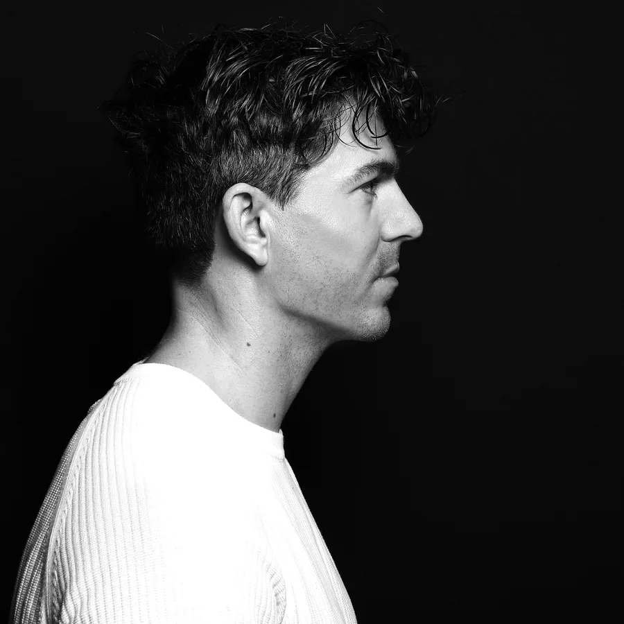 Mathew, 2 weeks after jawline and chin filler
