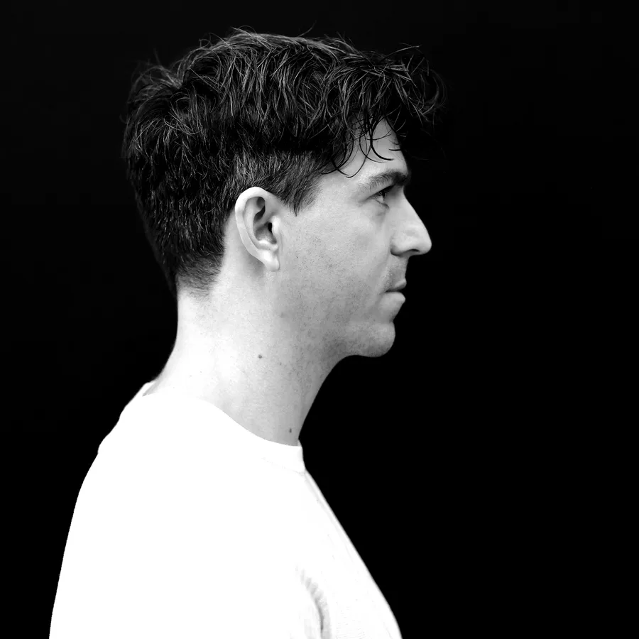 Mathew, before jawline and chin filler